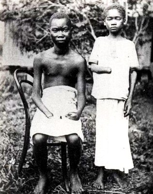 "Two youths from the Equator District", Schwarz-Weiß-Photographie, ca. 1904, Photographin: Alice Harris / Anti-Slavery International; Bildquelle: Twain, Mark: King Leopold's Soliloquy: A Defense of His Congo Rule, 2. Aufl., Boston 1905, wikimedia commons http://en.wikipedia.org/wiki/File:Amputated_Congolese_youth.jpg, gemeinfrei.