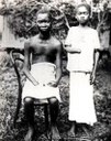 Verstümmelte Jugendliche im Kongo ca. 1904 IMG