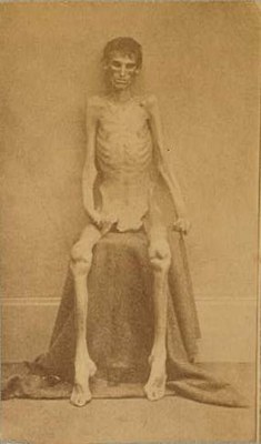 Prisoner of War During the Civil War 1865 IMG